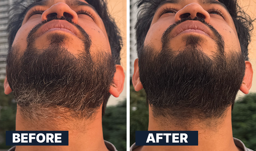 ALL MAN, 24-Hour Instant Grey Cover, Real Men, Real Results, Before-After 1