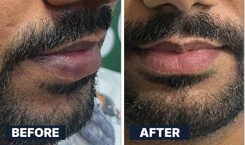 ALL MAN, Lightening Lip Scrub, Real Men, Real Results, Before-After 1