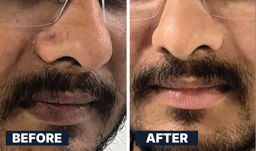 ALL MAN, Lightening Lip Scrub, Real Men, Real Results, Before-After 2