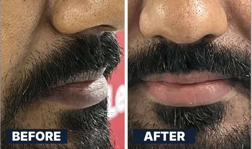 ALL MAN, Lightening Lip Scrub, Real Men, Real Results, Before-After 3