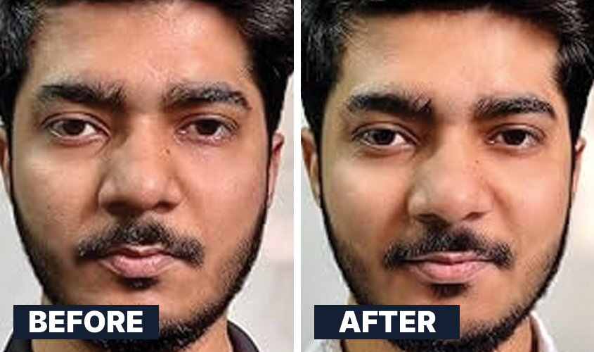 ALL MAN, Skin Brightening, Real Men, Real Results, Before-After 2