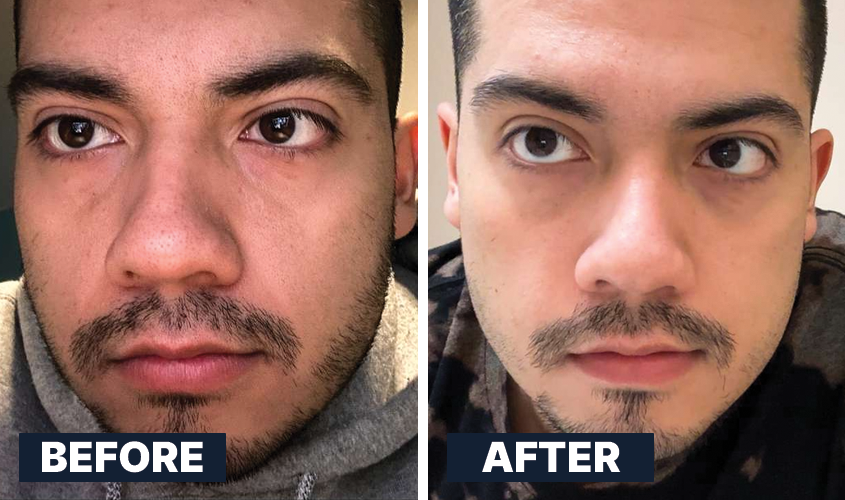 ALL MAN, Skin Brightening, Real Men, Real Results, Before-After 3